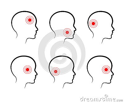 Types of headaches on a white background. Icon. Vector Vector Illustration